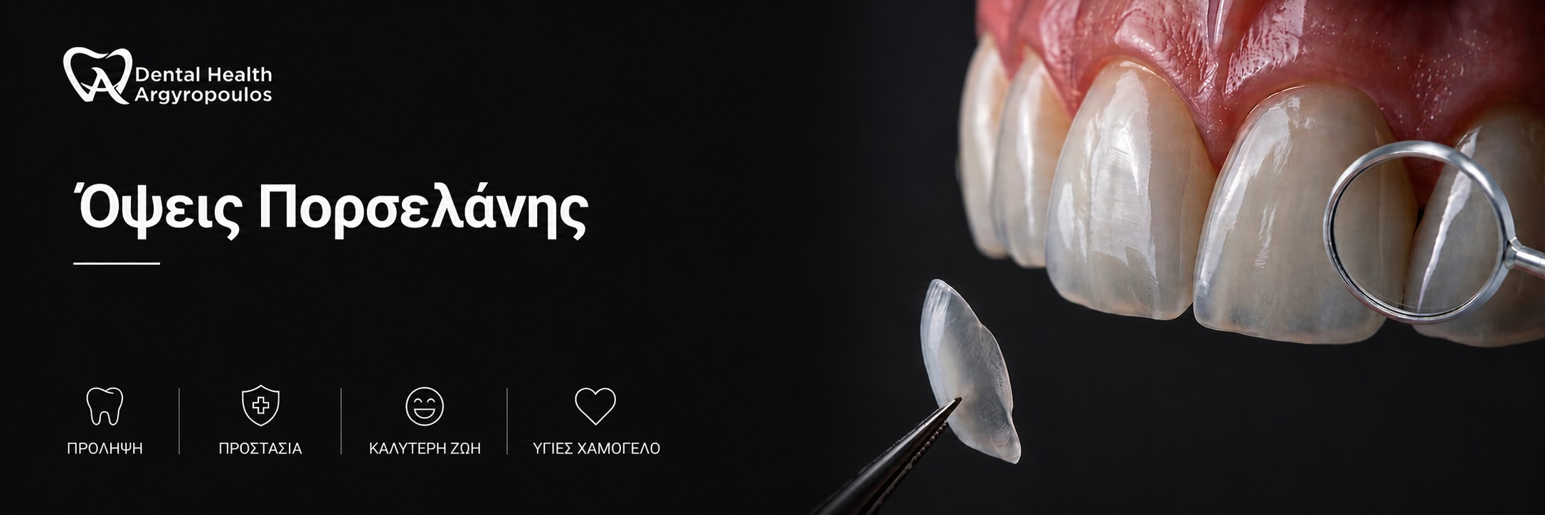 porcelain-veneers.jpg
